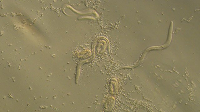 Caenorhabditis elegans, a free-living transparent nematode