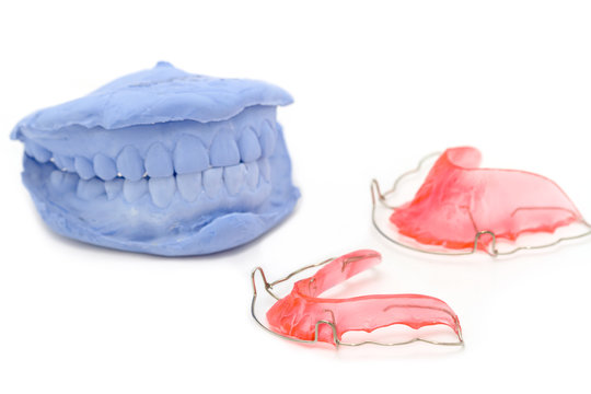 dental gypsum models and dental brace (Retainer)