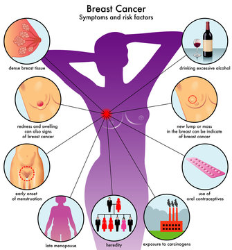 sintomi e fattori di rischio del cancro al seno