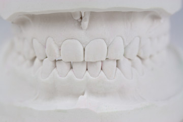 Zęby gipsowe - 65151243