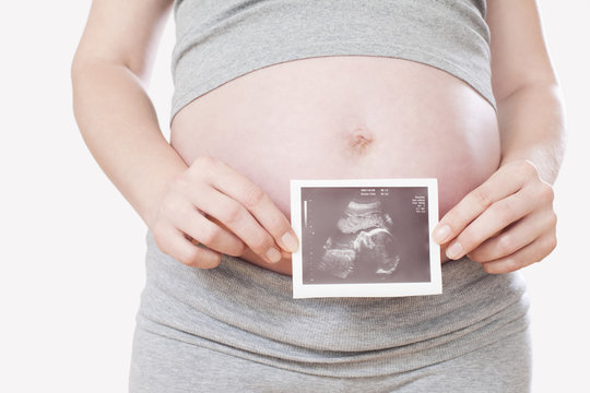 Schwangere Frau, mit Ultraschall- Bild , Mittelteil
