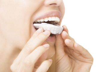 teeth Whitening - smiling girl with tooth tray