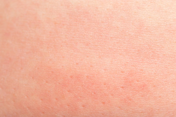 Fototapeta premium human skin as background