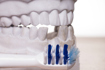 Zahnbürste und Model von einem menschlichen Gebiss