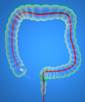 Colonscopia esame colon apparato digerente