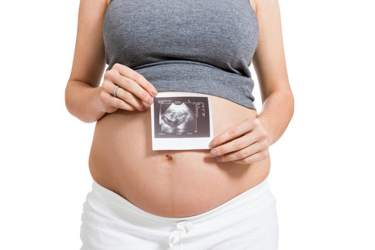 Pregnant woman displaying a prenatal ultrasound
