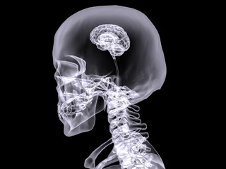 X-ray small brain #2 - 65503408