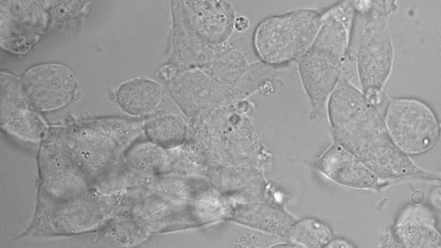 Human Embryonic Kidney 293 cells