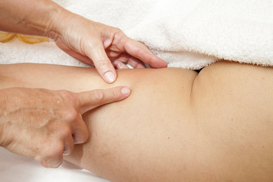 Anti cellulite massage with Ventuza vacuum body puller