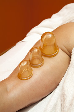 Anti cellulite massage Ventuza body pullers, close-up