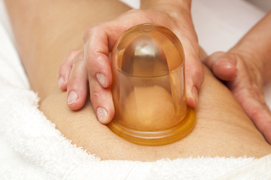 Anti cellulite massage with Ventuza vacuum body puller