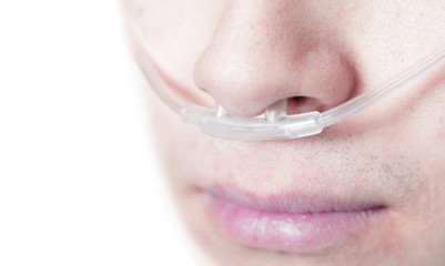 Oxygen tube on the face of a critically ill patient. Perhaps pro
