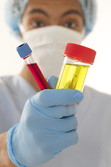 Young man doctor  holding a urine and blood sample