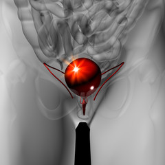 Bladder - Male anatomy of human organs - x-ray view