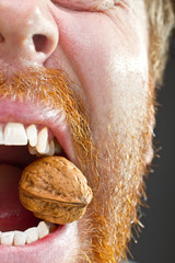 Walnut in teeth