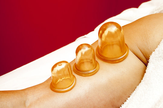 Anti cellulite massage Ventuza body pullers, close-up
