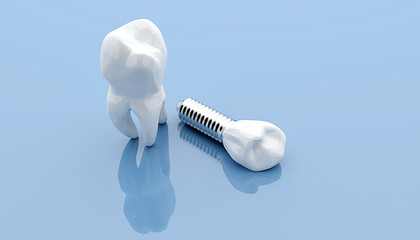 Dental implant and teeth - 65970063