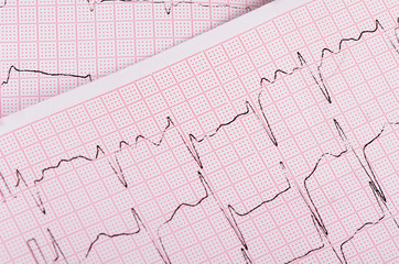 The tape with the cardiogram of a man