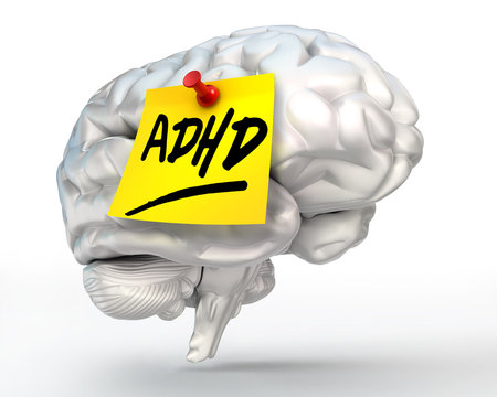 adhd yellow note on brain