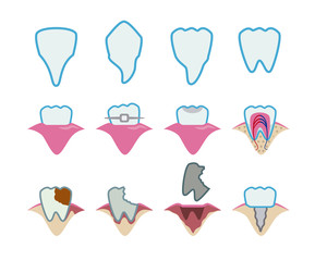 Dental design