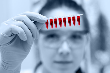 blood sample