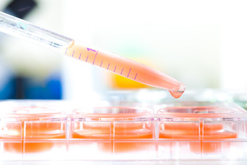 Blood test