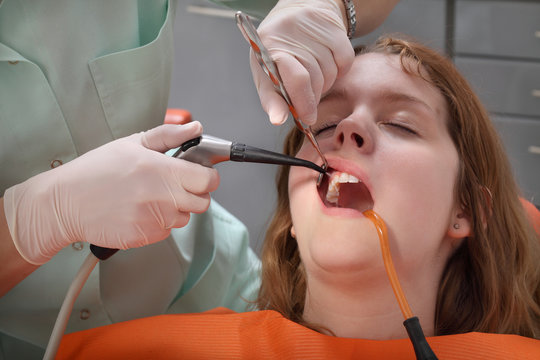 Dentist  splashing patient tooth after drilling or polishing
