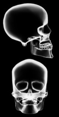 X-ray skull
