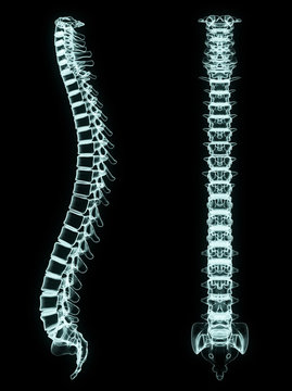 X-ray spine front and side