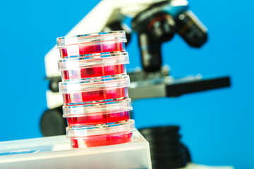 Petri dishes and laboratory microscope