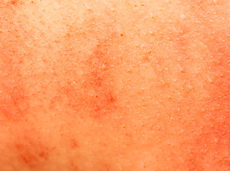 background of pig skin