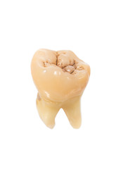 human tooth
