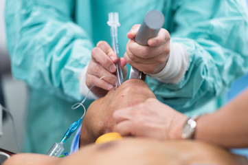 insertion endotracheal tube
