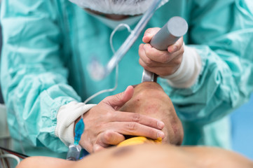 insertion endotracheal tube