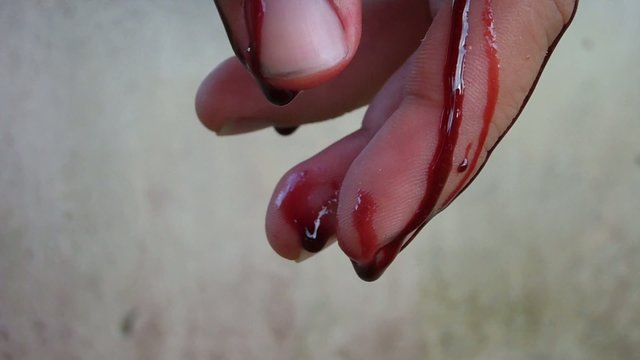 Hand of blood. Man wounded man in the blood. need some help