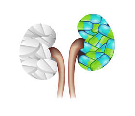 Pills in the kidney shape. Kidney treatment concept.