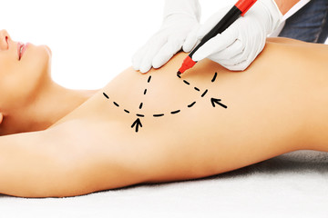 Doctor marking breast for surgery