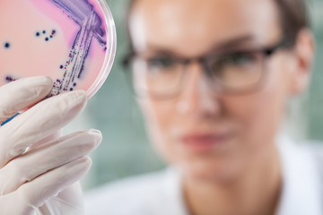 Microbiologist holding a Petri dish with bacteria