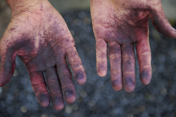 Brazilian Hands Stained from Acai Berries