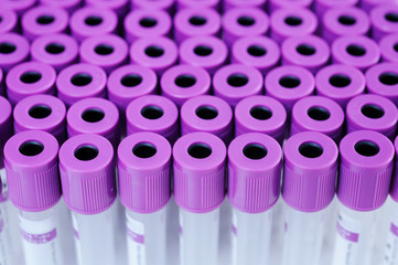 blood testing in laboratory