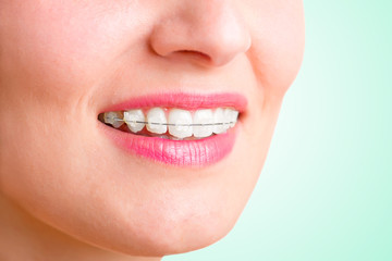 Braces