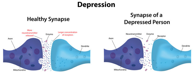 Depression Labeled Diagram