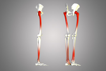 leg joints