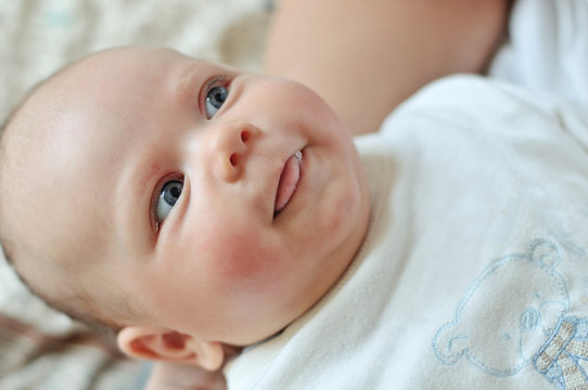 baby with red cheek