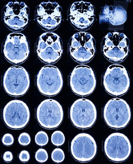 X-Ray scan human for brain