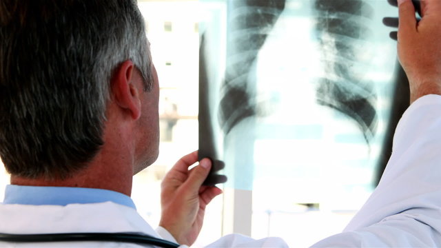 Doctor holding x-ray up to window