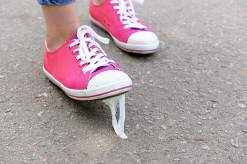 Foot stuck into chewing gum on street