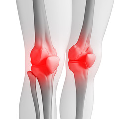 Human knee pain artwork
