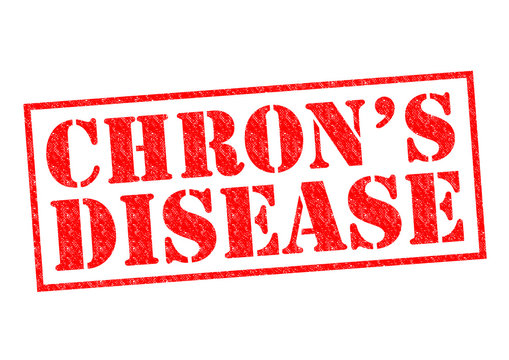 CHRONS DISEASE