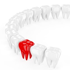 Aching tooth in row of healthy teeth. 3d